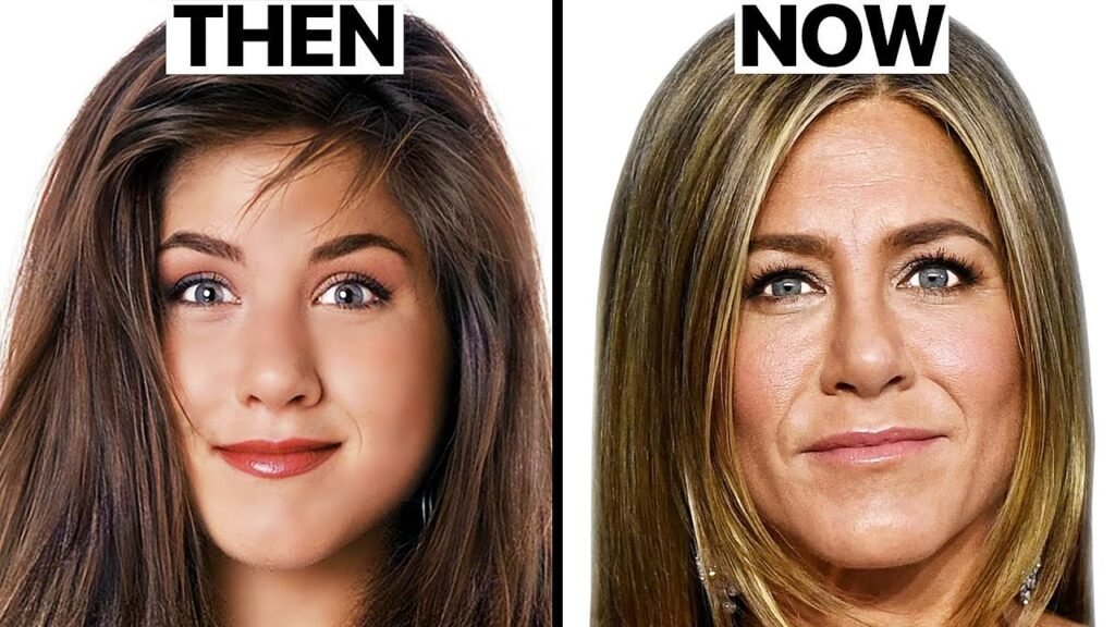 Jennifer Aniston Cosmetic Surgery